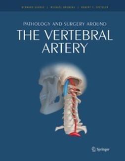 Surgical Anatomy of the Internal Carotid Artery | E-kirja | Ellibs  E-kirjakauppa